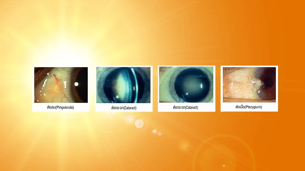 ยูวีจ๋า ตาลาก่อน