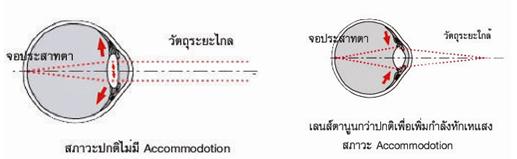 สายตายาวผู้สูงอายุ ( Presbyopia )