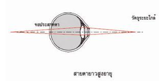 สายตายาวผู้สูงอายุ ( Presbyopia )