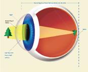 สายตาปรกติ