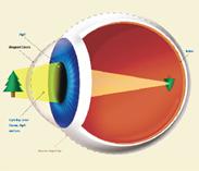 สายตาสั้น