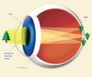สายตาเอียง