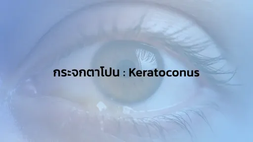 กระจกตาโปน : Keratoconus