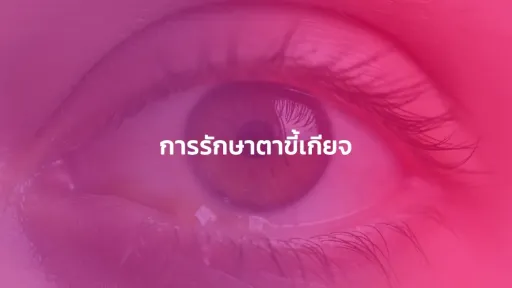 การรักษาตาขี้เกียจ