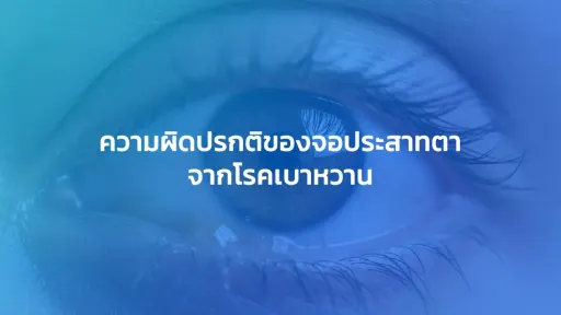 ความผิดปรกติของจอประสาทตาจากโรคเบาหวาน