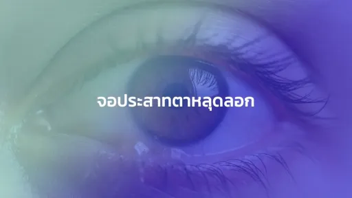จอประสาทตาหลุดลอก