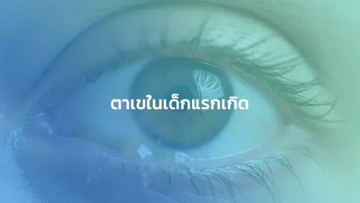 ตาเขในเด็กแรกเกิด