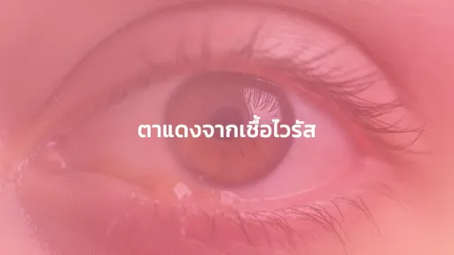 ตาแดงจากเชื้อไวรัส