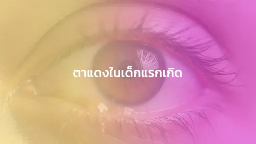 ตาแดงในเด็กแรกเกิด