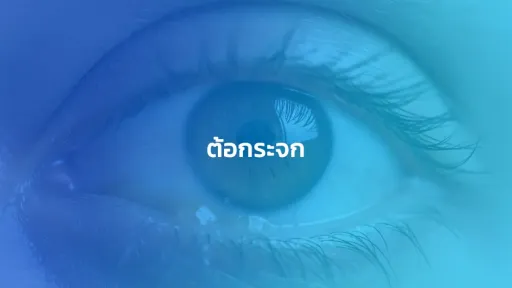 ต้อกระจก