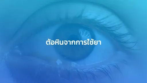 ต้อหินจากการใช้ยา