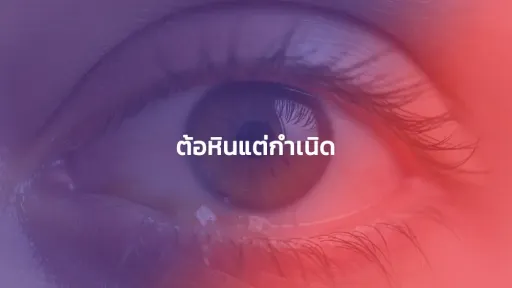 ต้อหินแต่กำเนิด