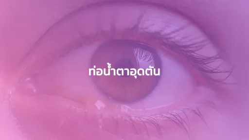 ท่อน้ำตาอุดตัน