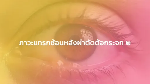 ภาวะแทรกซ้อนหลังผ่าตัดต้อกระจก 2