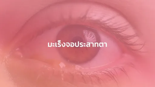 มะเร็งจอประสาทตา
