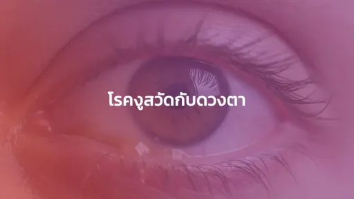 โรคงูสวัดกับดวงตา