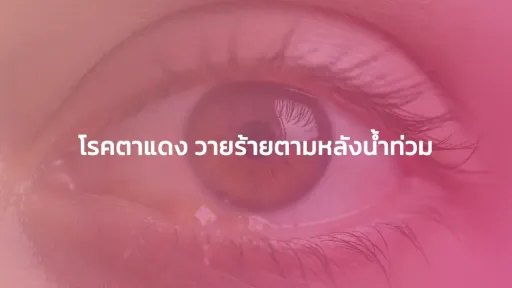 โรคตาแดง วายร้ายตามหลังน้ำท่วม