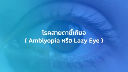 โรคสายตาขี้เกียจ ( Amblyopia หรือ Lazy Eye )
