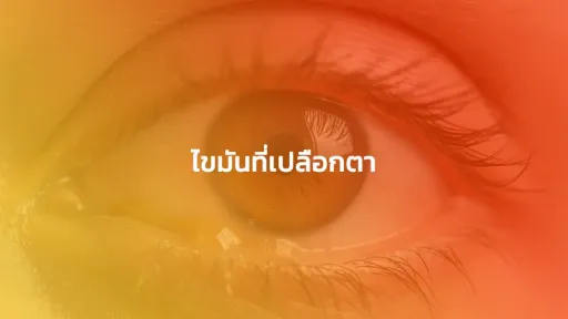 ไขมันที่เปลือกตา