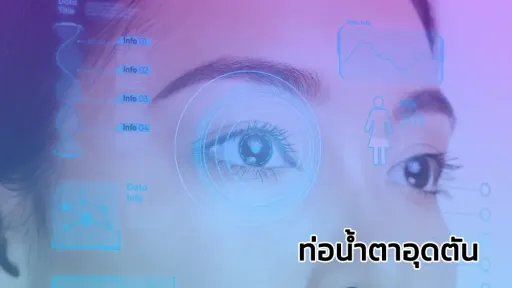 กรอบแว่น BOLON พร้อมเลนส์โปรเกรสซีฟเฉพาะบุคคล แถมฟรี! เลนส์เปลี่ยนสี