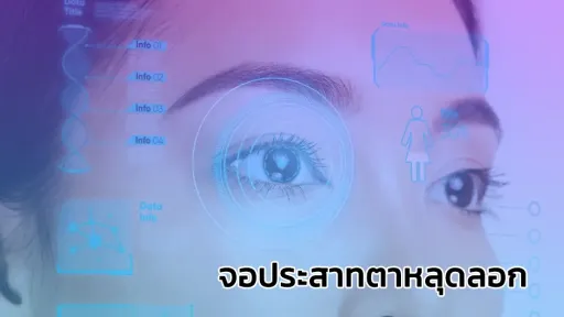 จอประสาทตาหลุดลอก