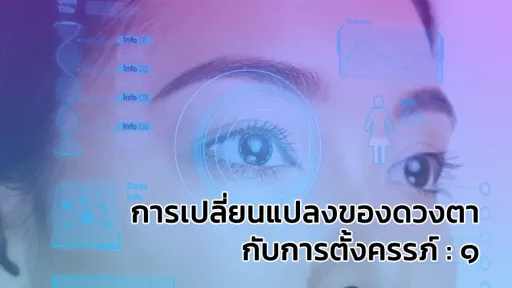 การเปลี่ยนแปลงของดวงตากับการตั้งครรภ์ : 1