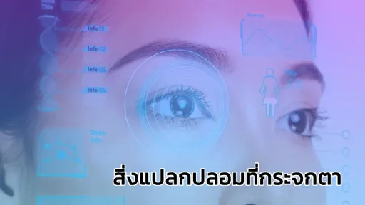 สิ่งแปลกปลอมที่กระจกตา