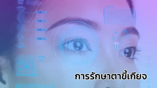 การรักษาตาขี้เกียจ