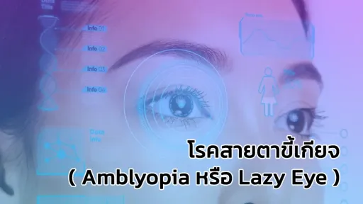 โรคสายตาขี้เกียจ ( Amblyopia หรือ Lazy Eye )