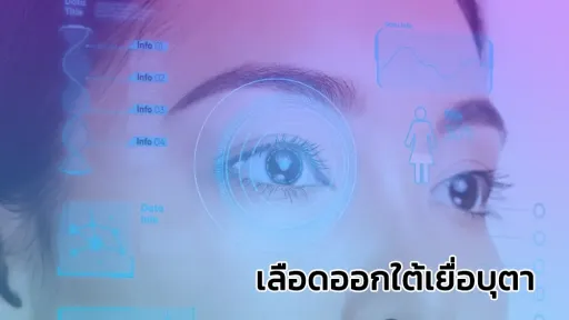 กรอบแว่น STEPPER น้ำหนักเบา ใส่สบายตลอดทั้งวัน ดีไซน์ Minimal ทันสมัย เหมาะกับทุกใบหน้า พร้อมกับ เลนส์โปรเกรสซีฟเฉพาะบุคคล ISOPTIK MP ย่อบาง 1.6 Blue Block 