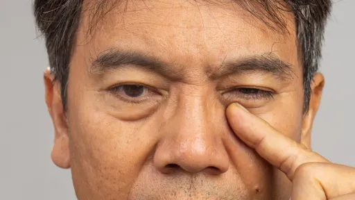 ต้อลมอันตรายไหม