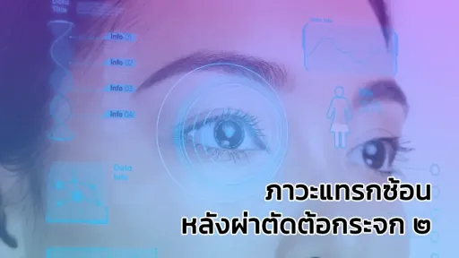 กรอบแว่น SEIKO ไทเทเนียม นำเข้าจากญี่ปุ่น แข็งแรง ทนทาน น้ำหนักเบา ใส่สบายทั้งวัน พร้อมกับ เลนส์โปรเกรสซีฟเฉพาะบุคคลอย่างยิ่งยวด ISOPTIK SMP ย่อบาง 1.6 Blue Block Lab เยอรมัน