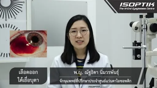 เลือดออกใต้เยื่อบุตา