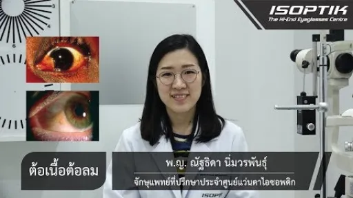 สุขภาพสายตา " ต้อเนื้อต้อลม "  - โดย แพทย์หญิง ณัฐธิดา นิ่มวรพันธุ์