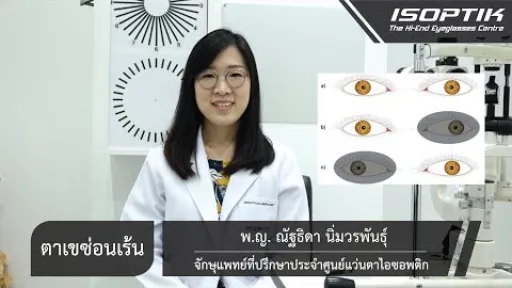 ตาเขซ่อนเร้น