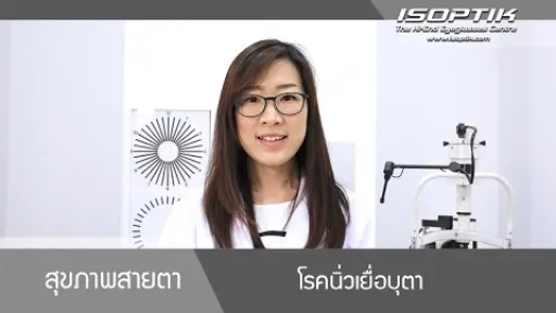 สุขภาพสายตา " นิ่วเยื่อบุตา ( Conjunctival concretion ) "  - โดย แพทย์หญิง ณัฐธิดา นิ่มวรพันธุ์