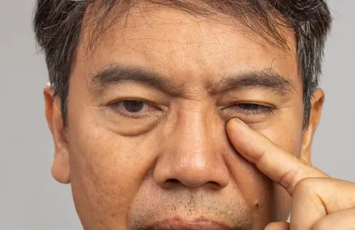 ต้อลมอันตรายไหม