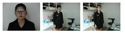 คนไข้ใส่แว่นทดลองเดิน หรือใช้สายตาตามปกติ 