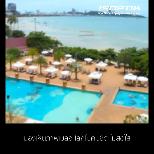 มองเห็นภาพไม่ชัด