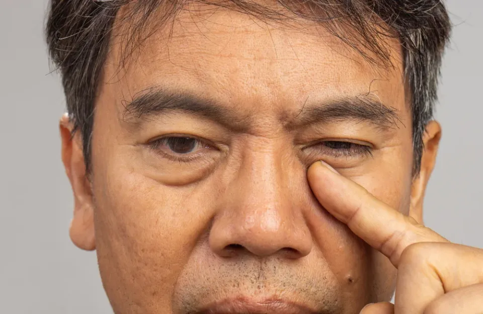 ต้อลมอันตรายไหม