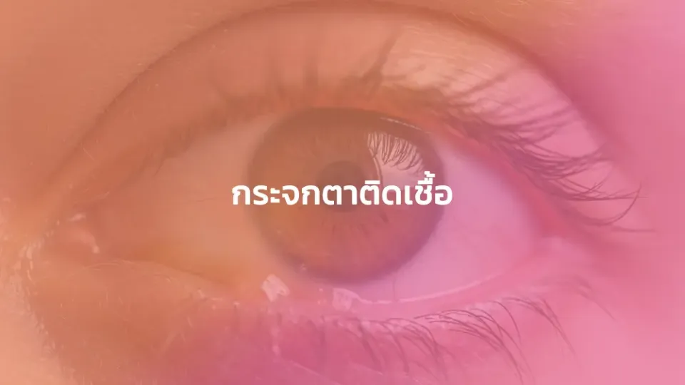 กระจกตาติดเชื้อ