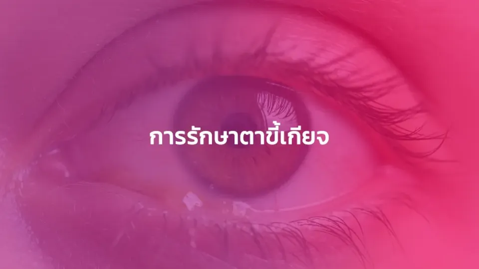 การรักษาตาขี้เกียจ