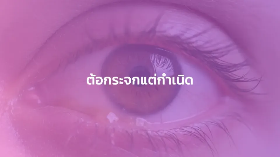 ต้อกระจกแต่กำเนิด