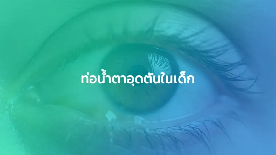 ท่อน้ำตาอุดตันในเด็ก