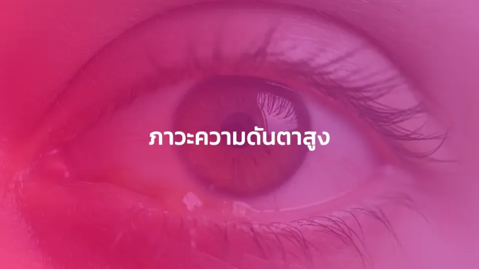 ภาวะความดันตาสูง