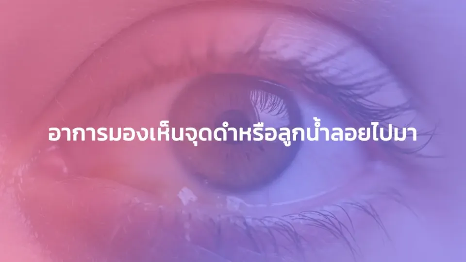 อาการมองเห็นจุดดำหรือลูกน้ำลอยไปมา