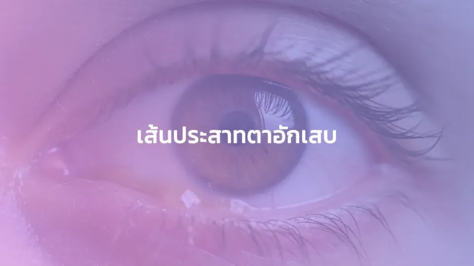 เส้นประสาทตาอักเสบ