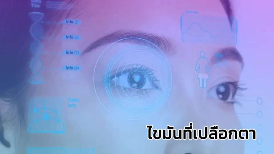 ไขมันที่เปลือกตา