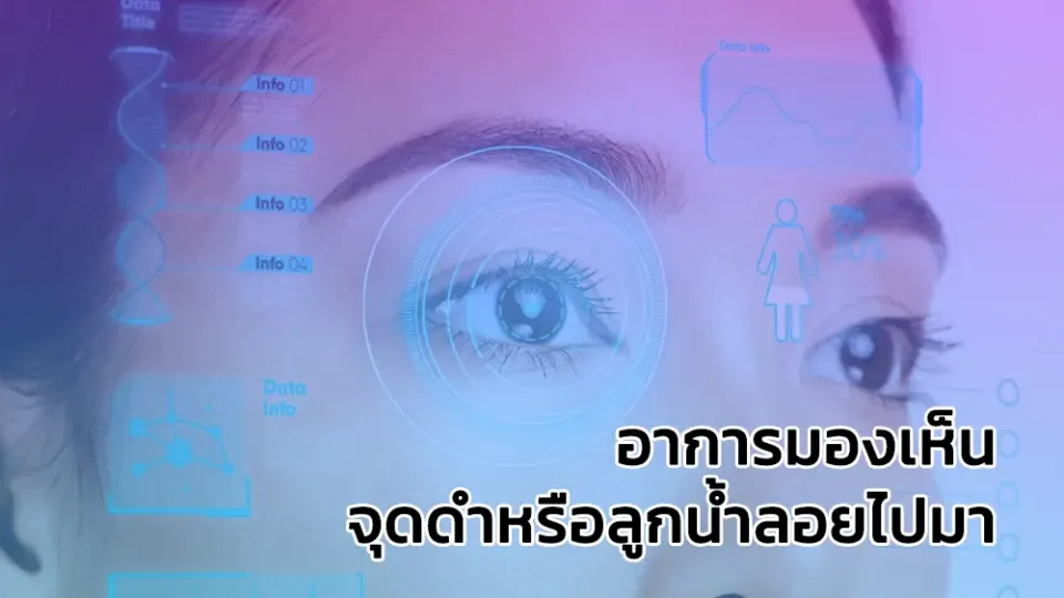 อาการมองเห็นจุดดำหรือลูกน้ำลอยไปมา