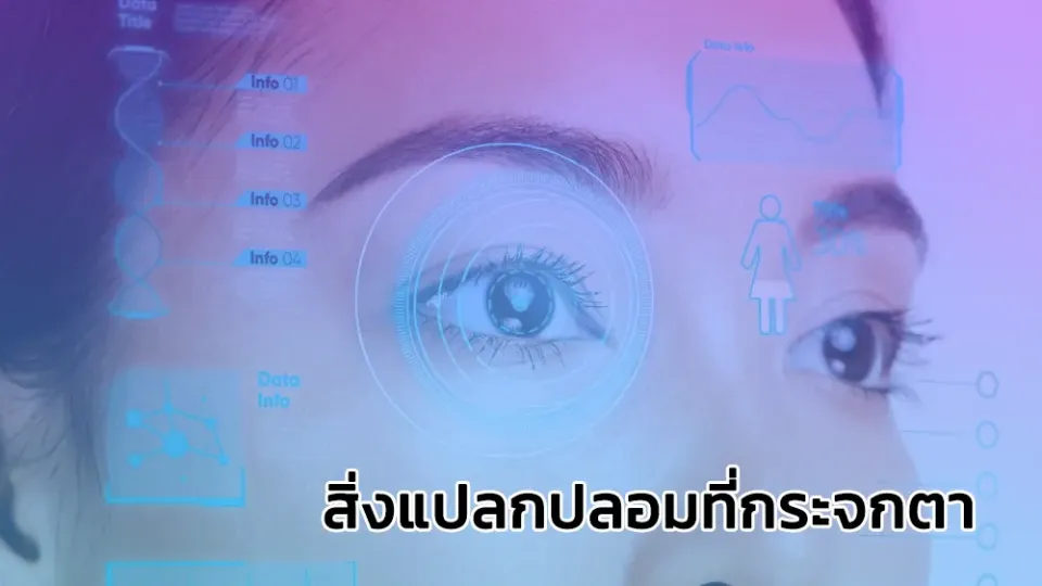 สิ่งแปลกปลอมที่กระจกตา